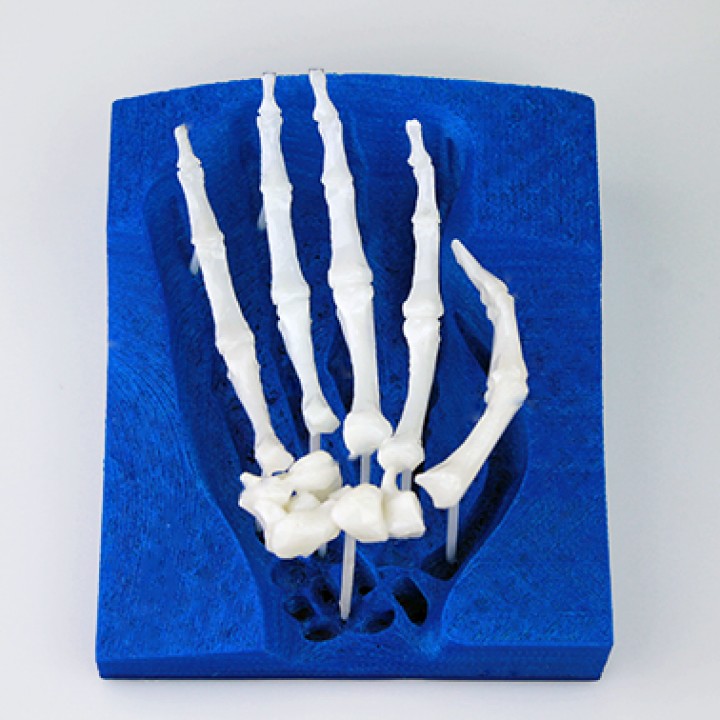 Skeletal Hand image