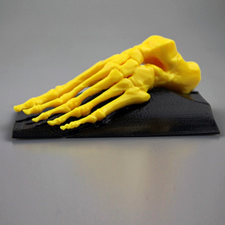 Skeletal Foot image