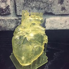 Picture of print of Human Heart