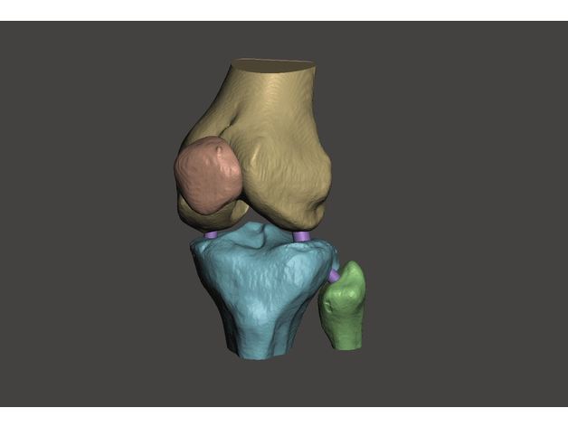 Knee (from CT scan) image