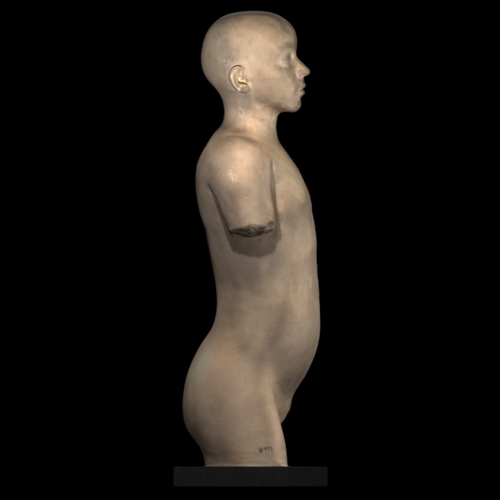 Plaster model of torso and head, showing partial dissection image