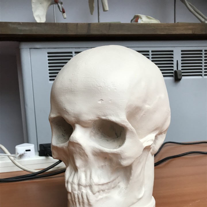 Skull cast of Dr. Johann Caspar Spurzheim image