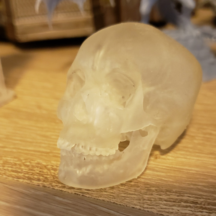 CT Skull Scan image