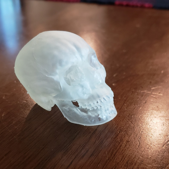 ct scan skull 3d print
